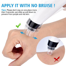 Load image into Gallery viewer, Blackhead Vacuum Remover
